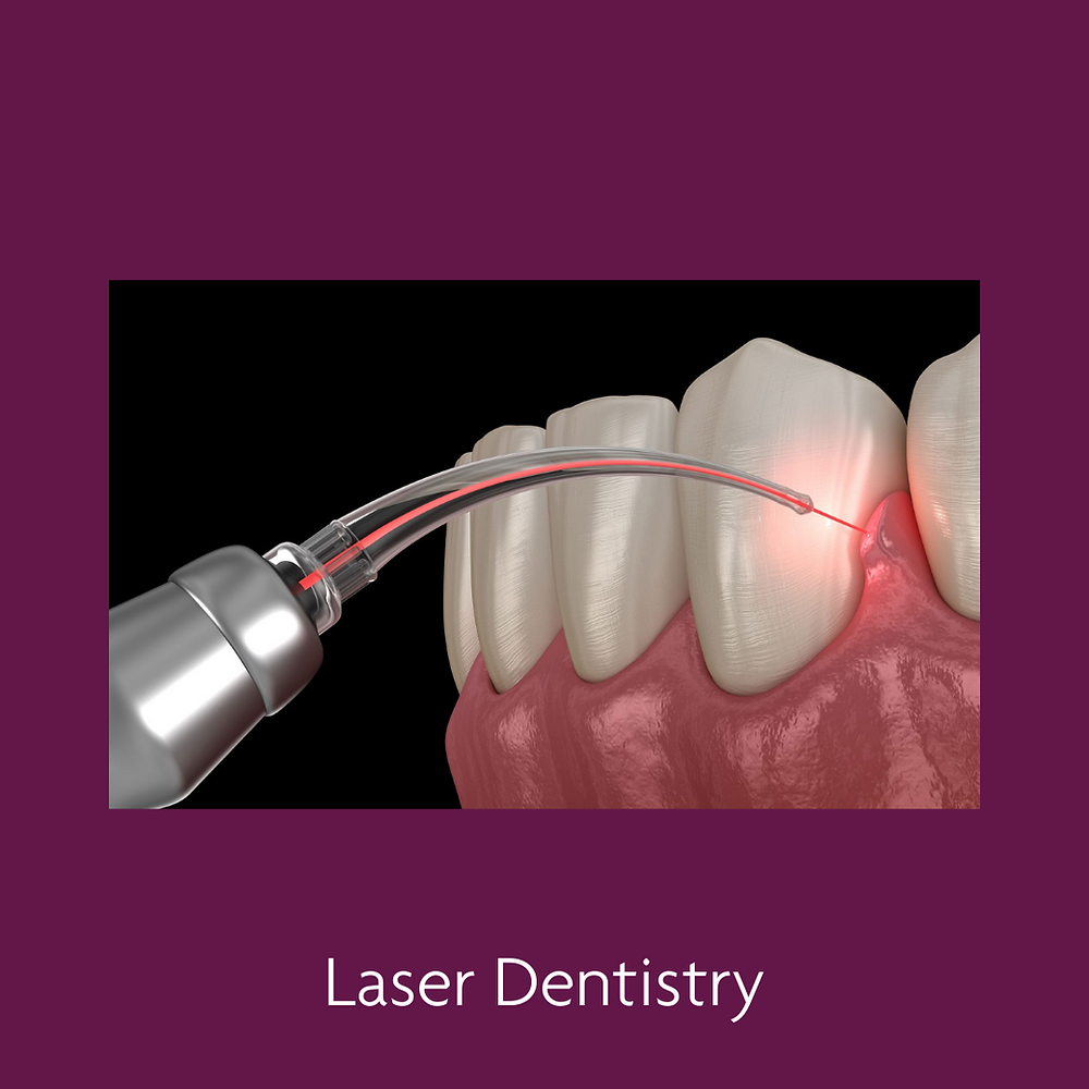 Che cos'è la Dentista Laser?