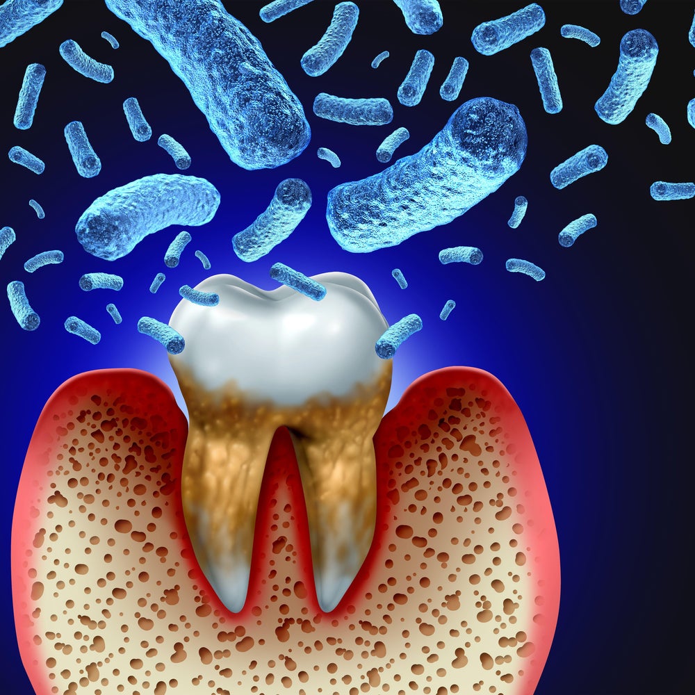 The Connection Between Chronic Conditions and Oral Health