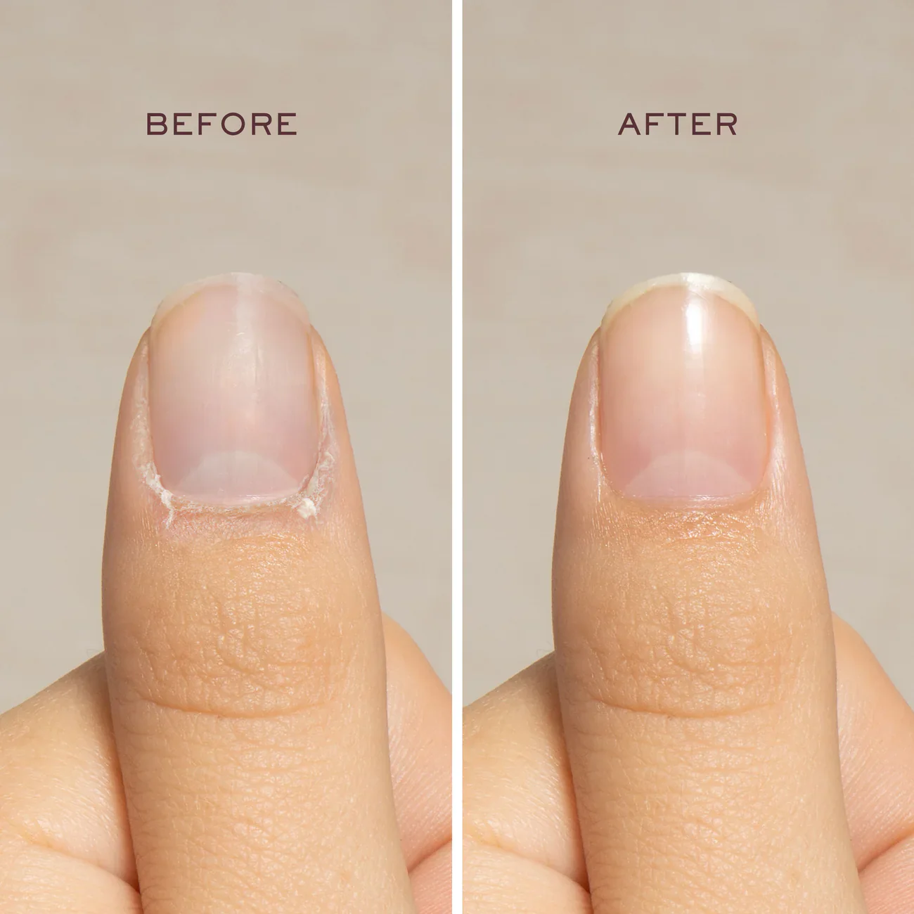 Cuticle Care