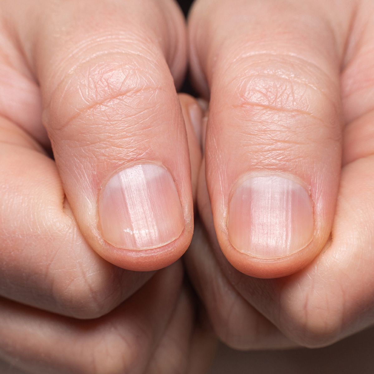 Signs of Dehydrated Nails