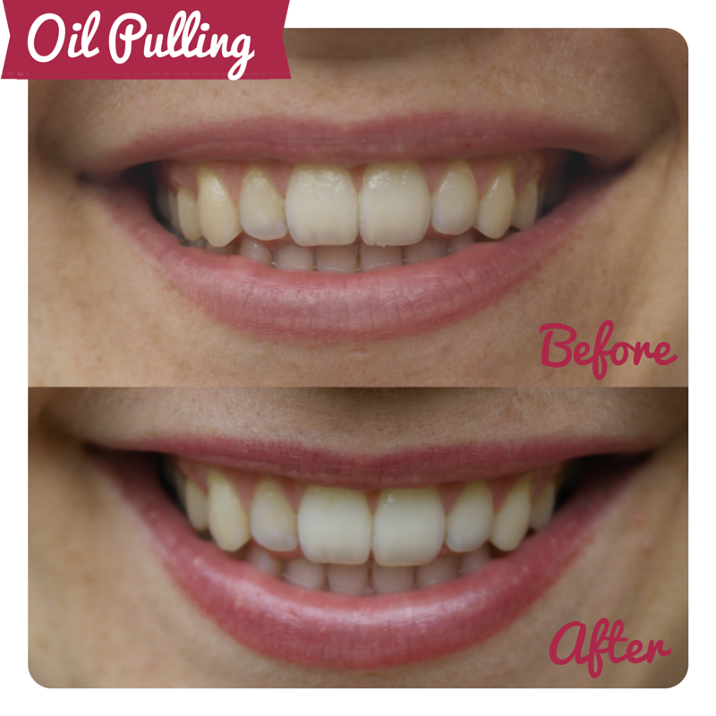 Oil Pulling