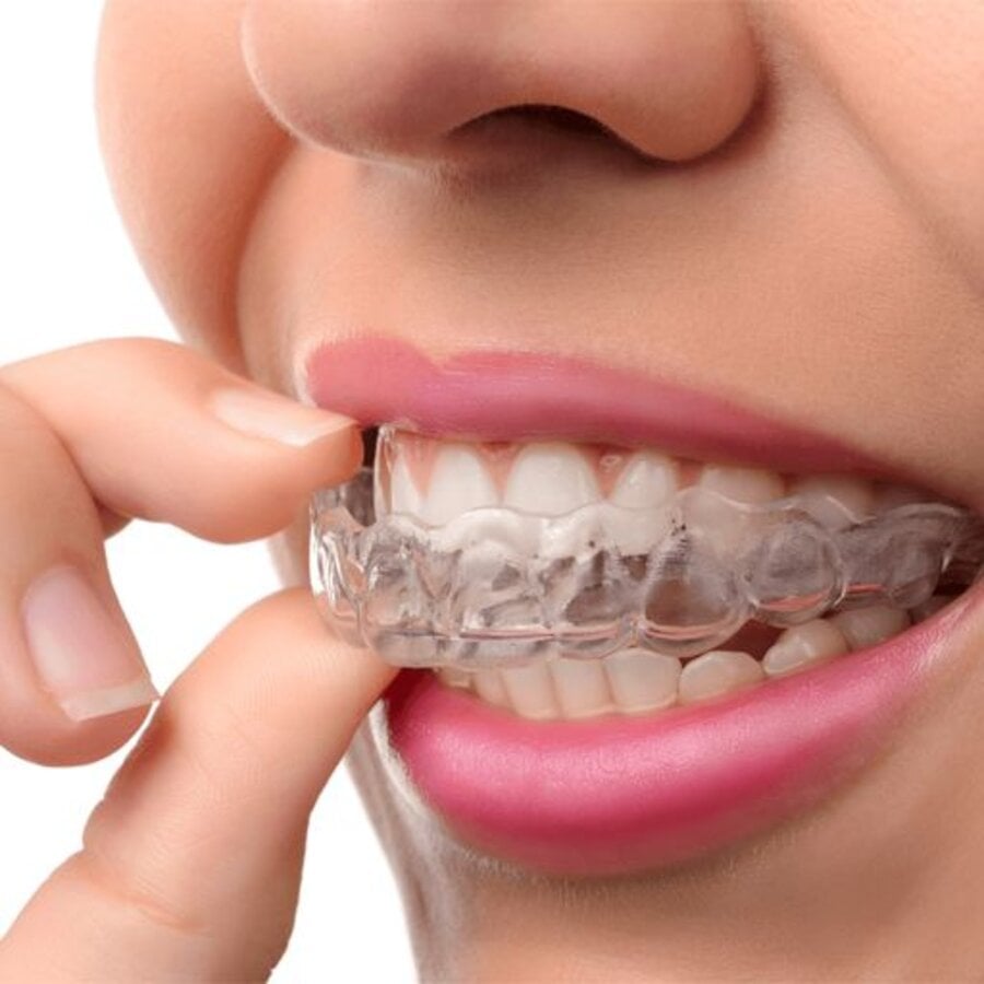 Misure Preventive per la Sensibilità Dentale