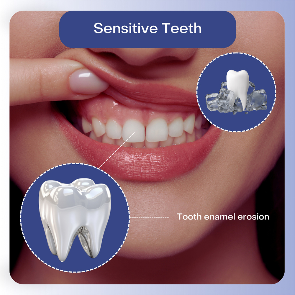 Understanding Tooth Sensitivityv