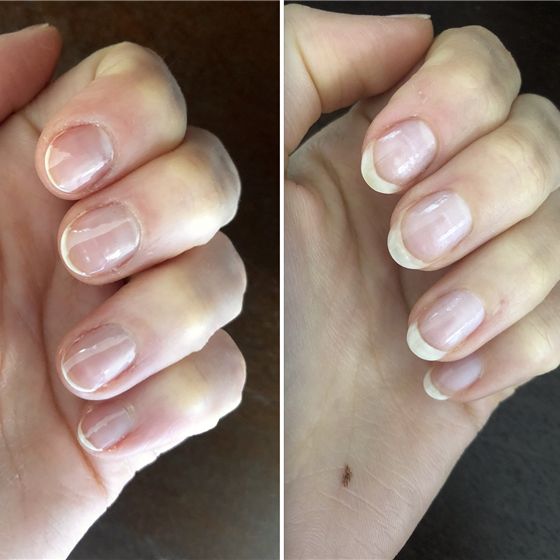 Strengthen Weak Nails