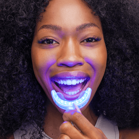 Consigli per Utilizzare i Kit di Sbiancamento dei Denti a LED